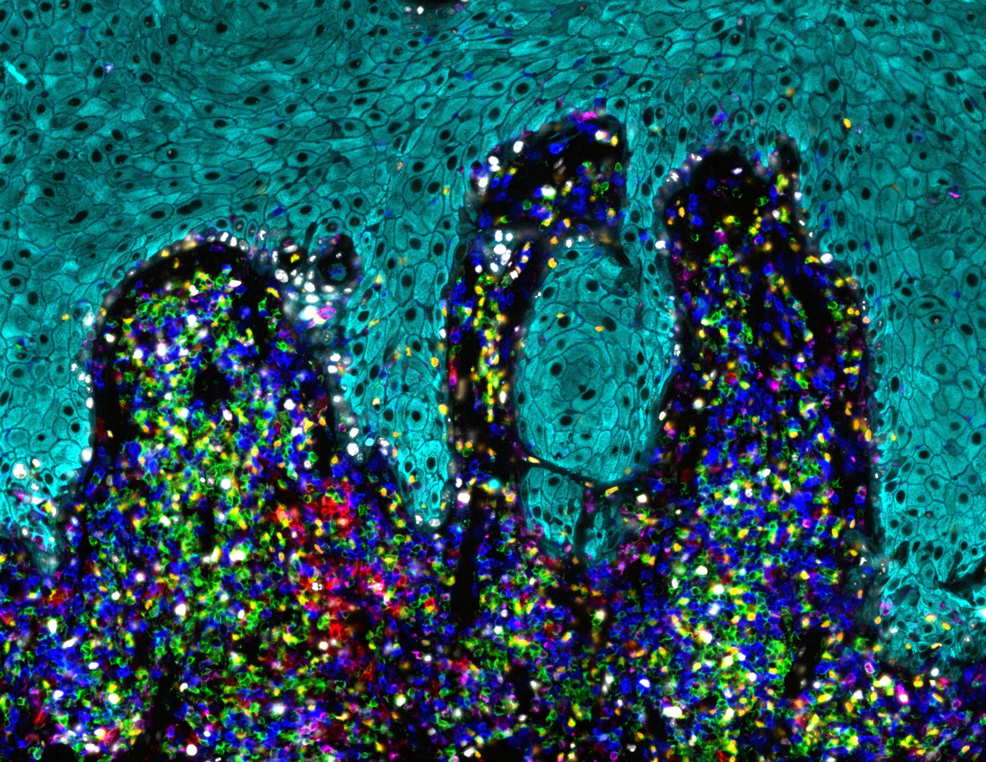 orion_lichen-plan-ici-induced_garaud