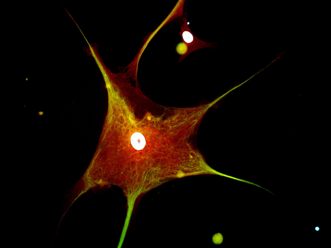 Neurones2