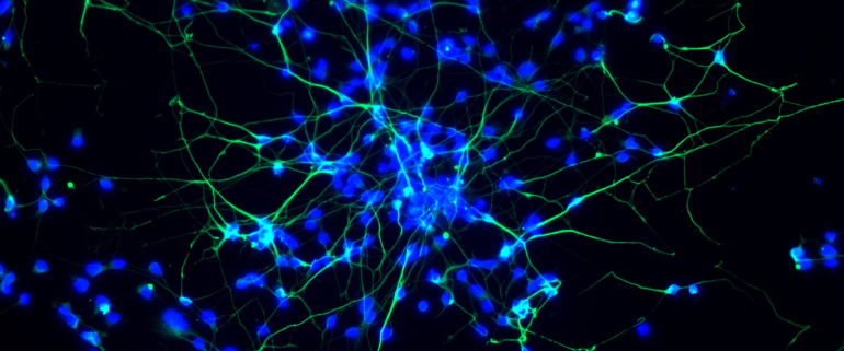Réseau de neurones